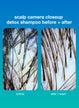 scalp camera closeup detox shampoo before + after
